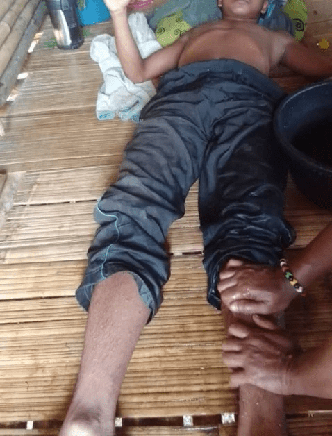 18yo M'sian Struck By Lightning While Using Earphones, Now Unable To Stand