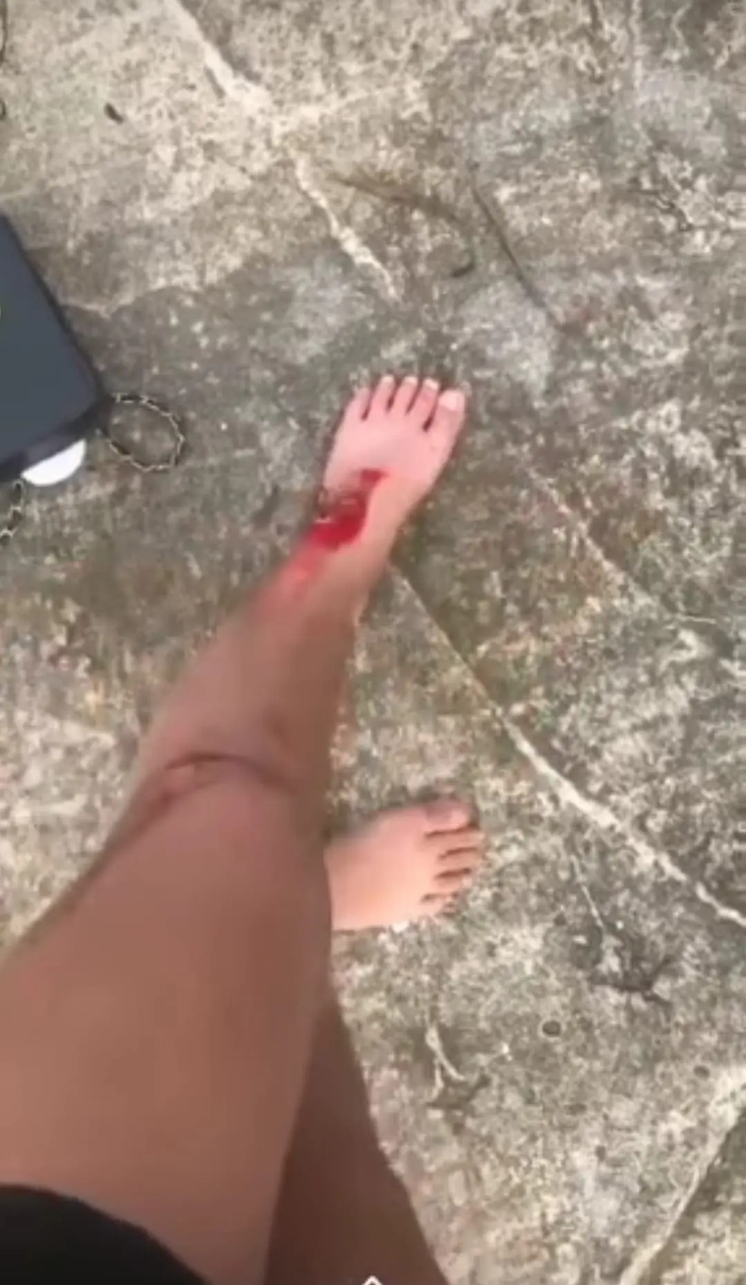 Girl's injury after jumping off after being allegedly molested and robbed 2