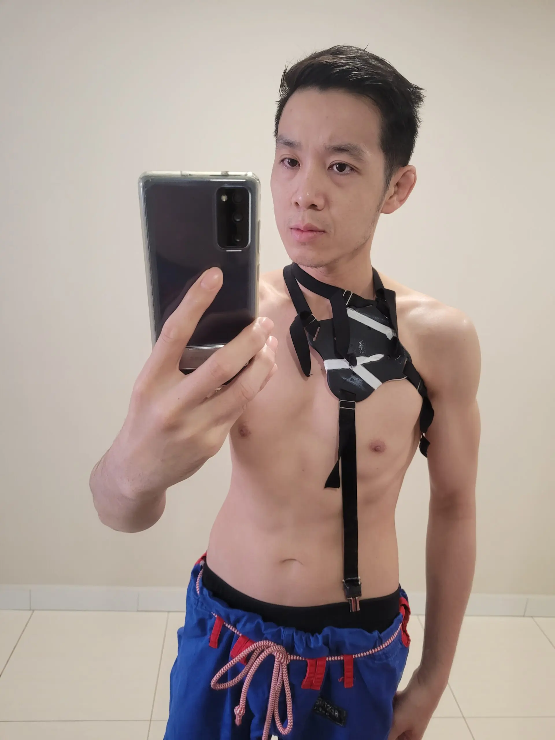 Tan Jee Tjun  with chemo port