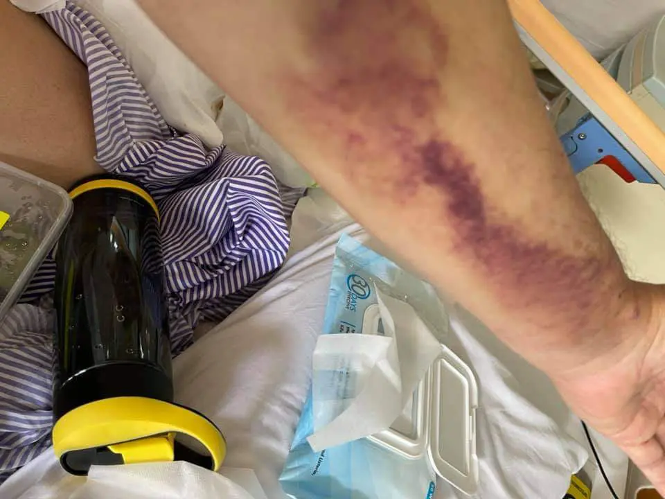 COVID positive doctor records video in ICU to urge the public to follow SOPs