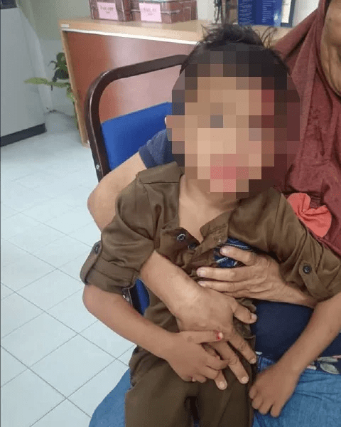 3yo M'sian boy who fell out from car window