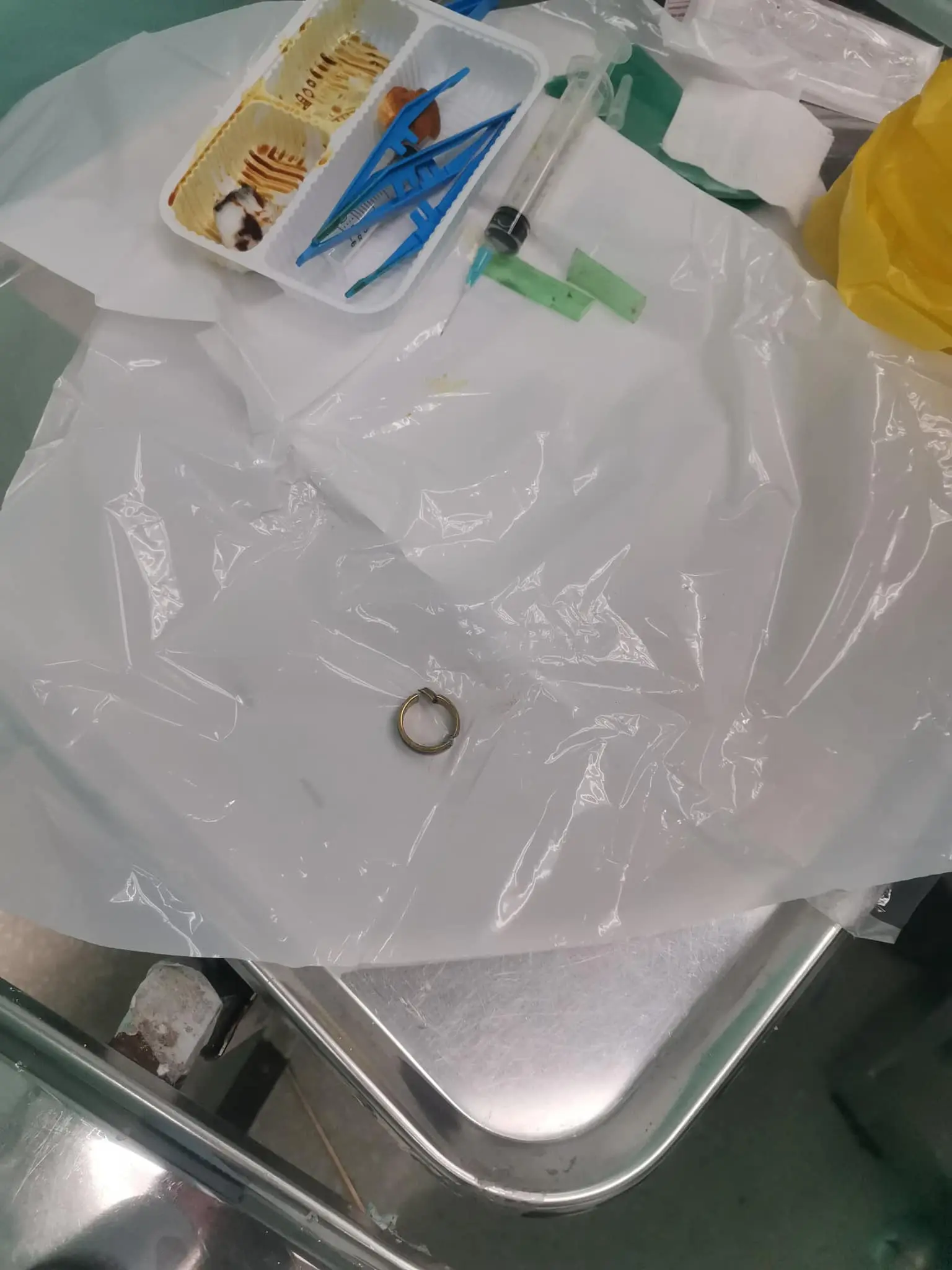 M'sian Man Calls Firefighters For Help After Metal Ring Gets Stuck On His Genitals