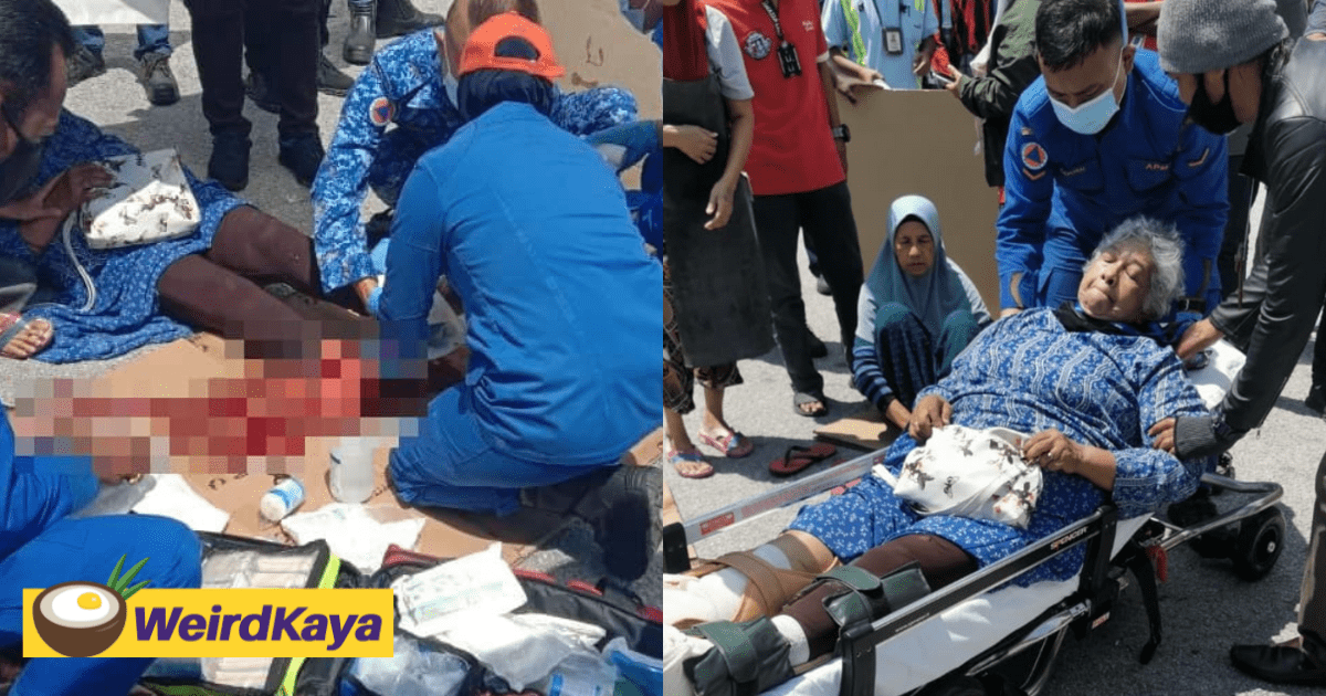 75yo M'sian Cleaner Loses Her Legs After It Was Crushed By Forklift At MASKargo Complex