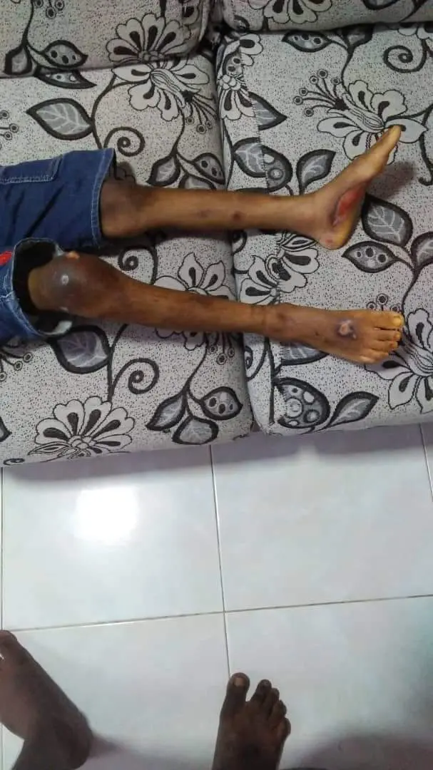 Iskandar puteri nanny abuse kids legs