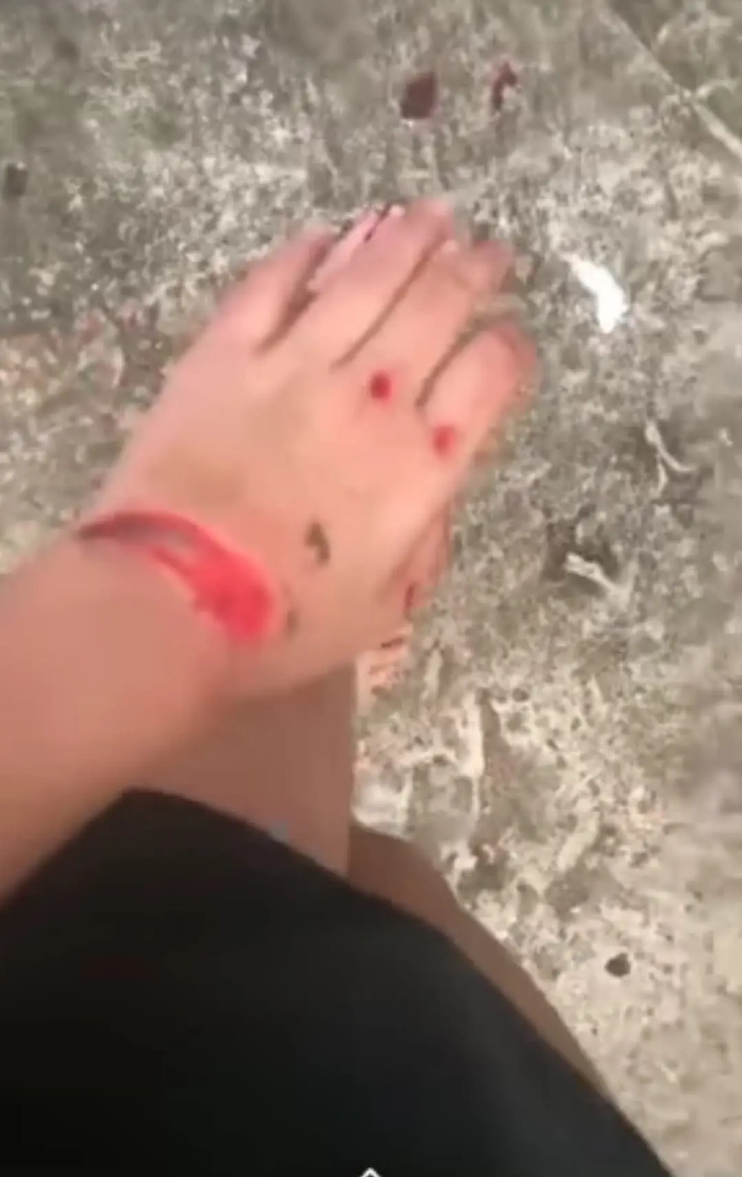 Girl's injury after jumping off after being allegedly molested and robbed 1