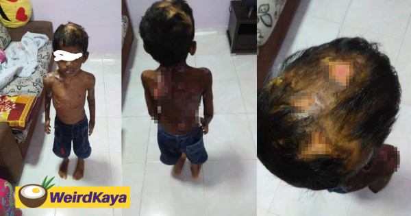 'They don't deserve this!' Single mom's children allegedly abused by couple with hot water and cigarettes