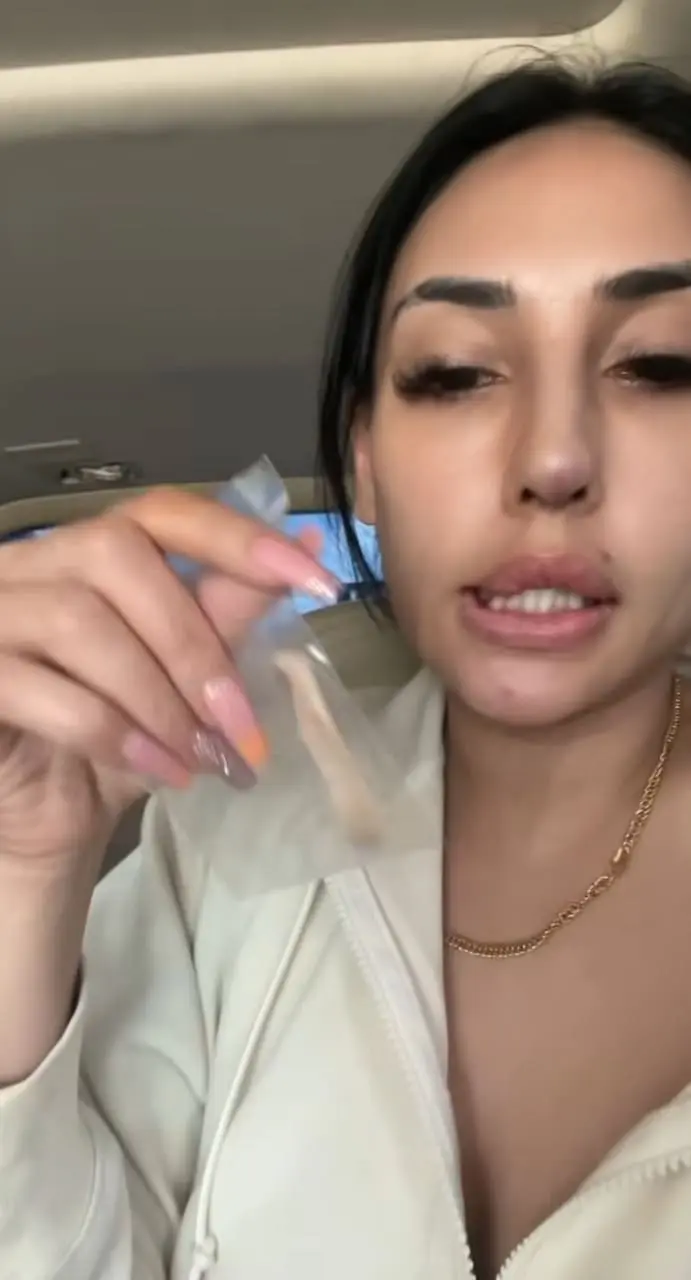 anju showing the removed reused nose implant from her nose