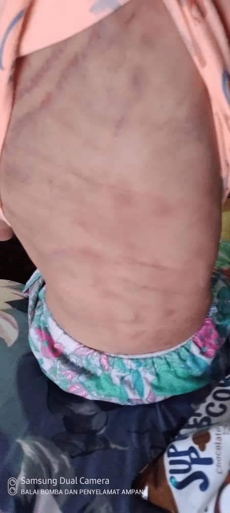 8yo Child Abuse Victim Rescued By Firefighters From The 4th Floor Of Ampang Apartment