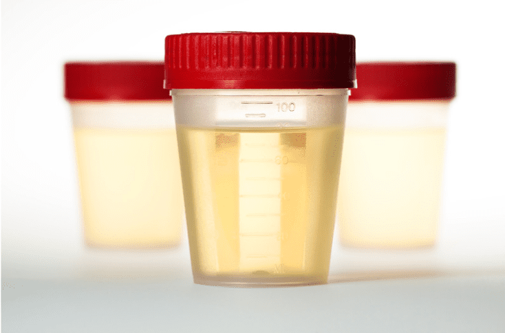 Bottle of urine sample