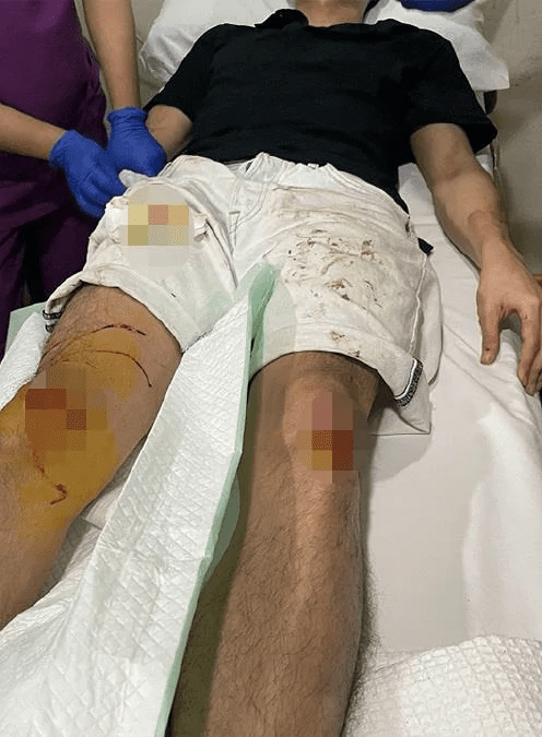 M'sian cat breeder injured by parang