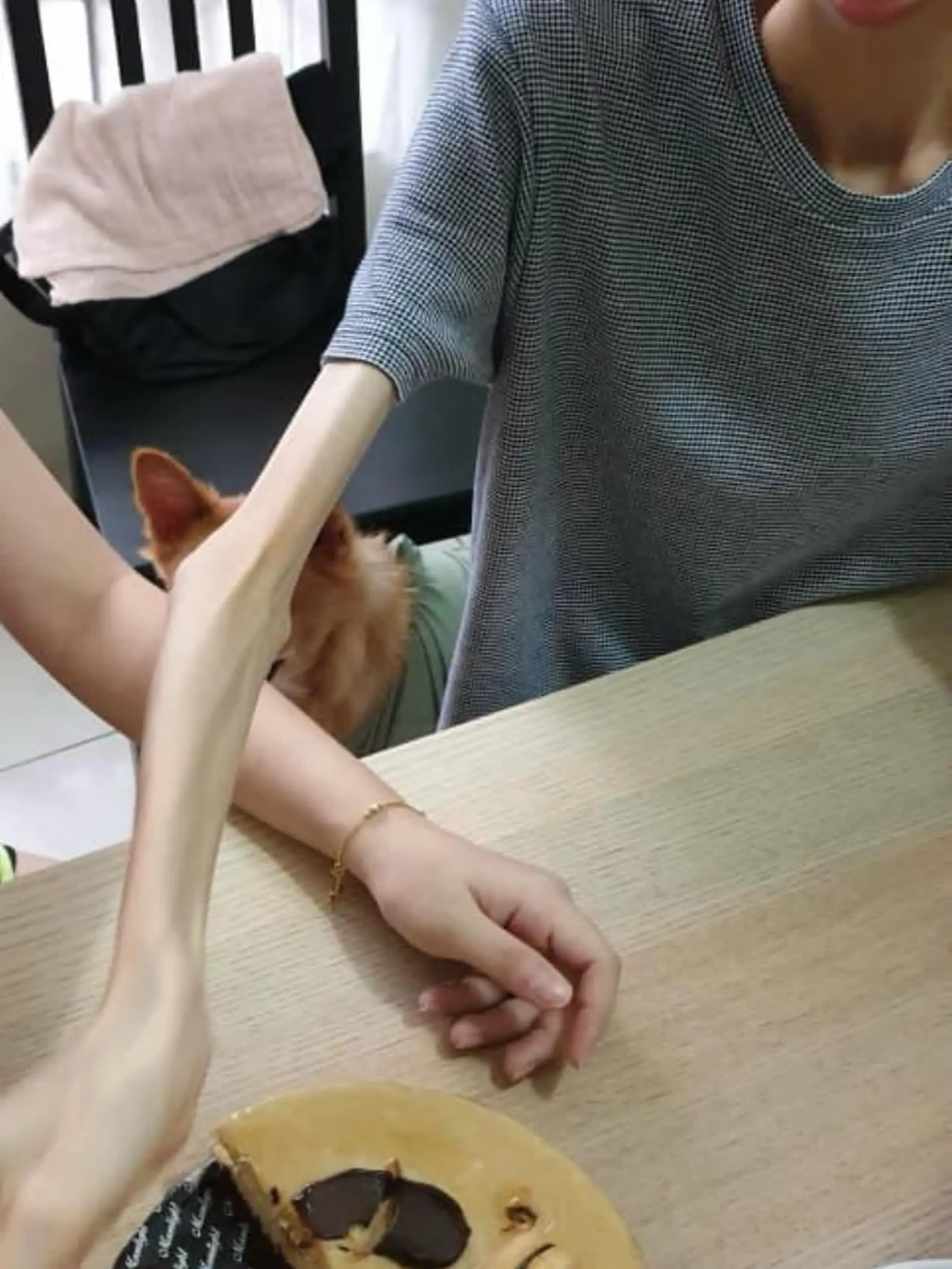 Comparison of Fion's arm with anorexia VS normal people