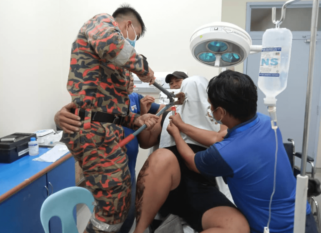 18yo Sabah Teen Gets Arrow Stuck Inside Nose While Fishing With Friends