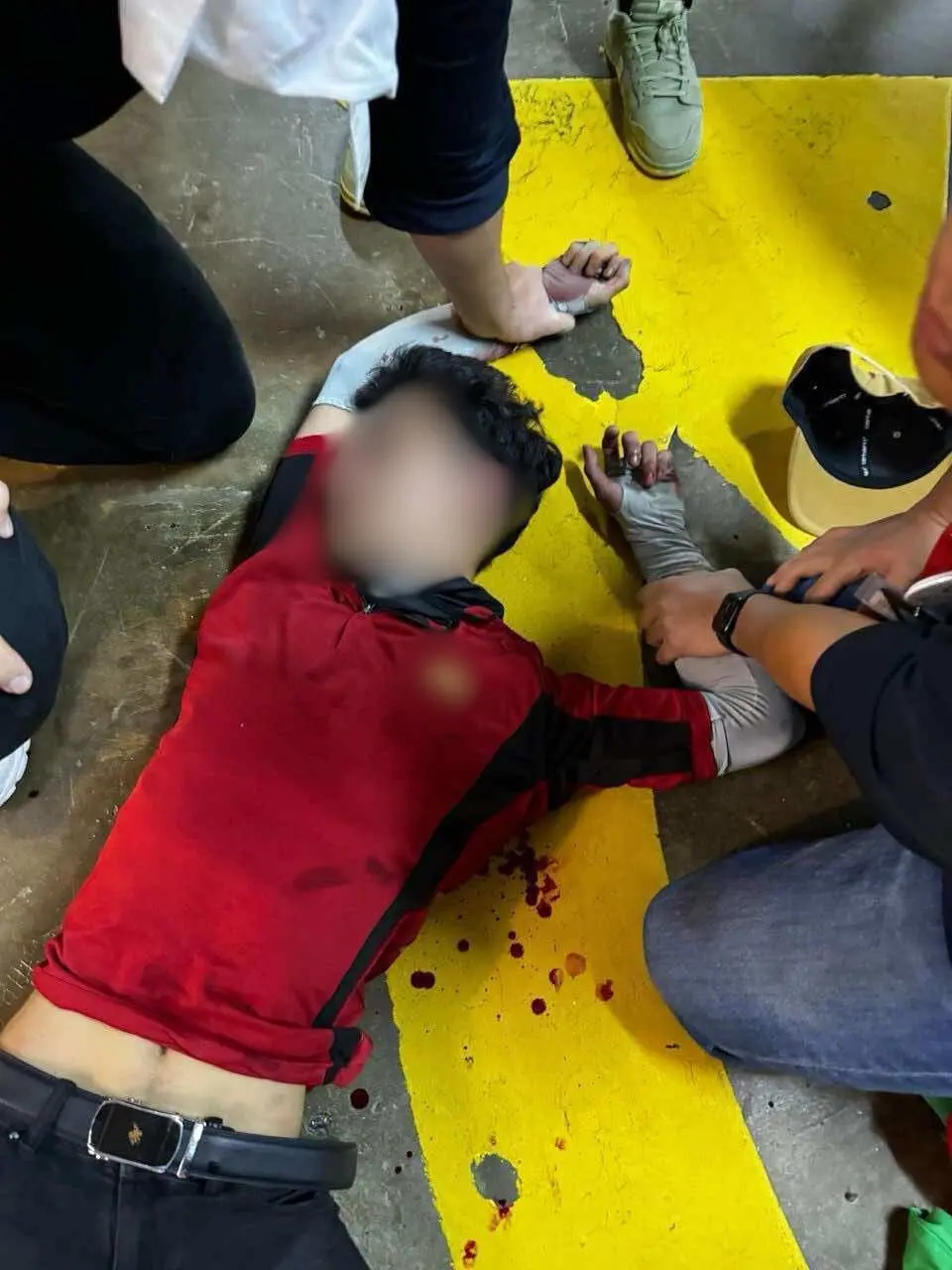 M'sian Man Left Bleeding After Robber Slashes Him Over Staredown Inside Toilet