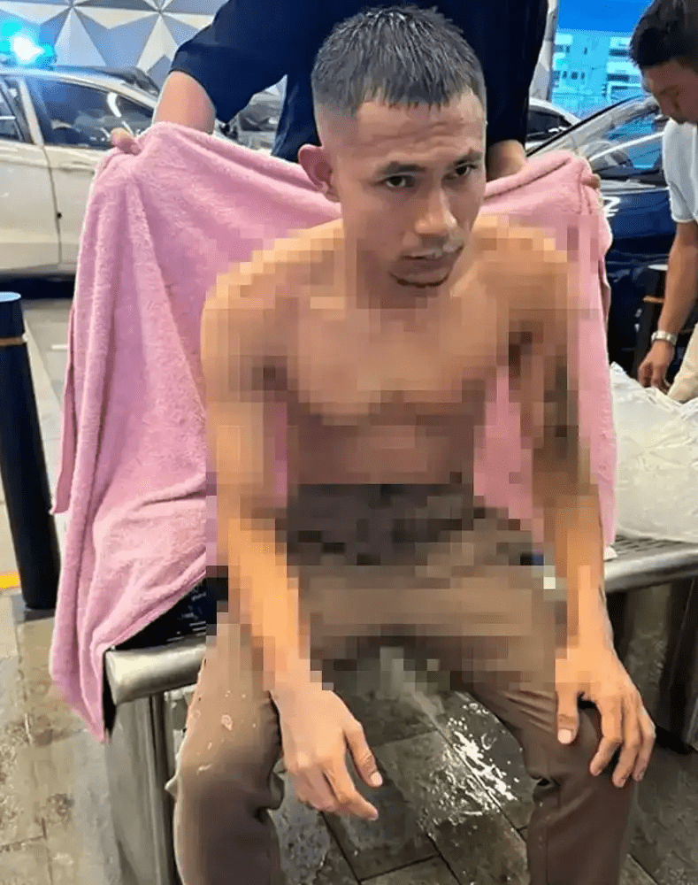 Faisal Halim covered with a towel after acid attack
