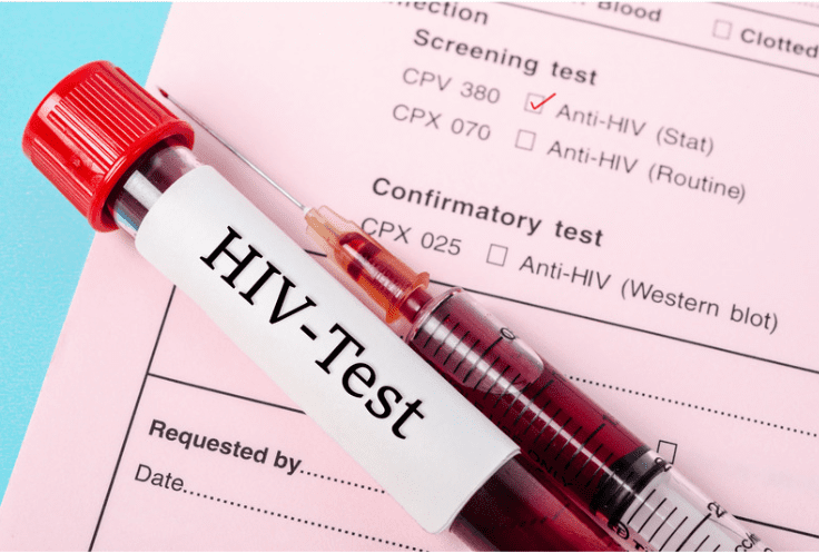 HIV test