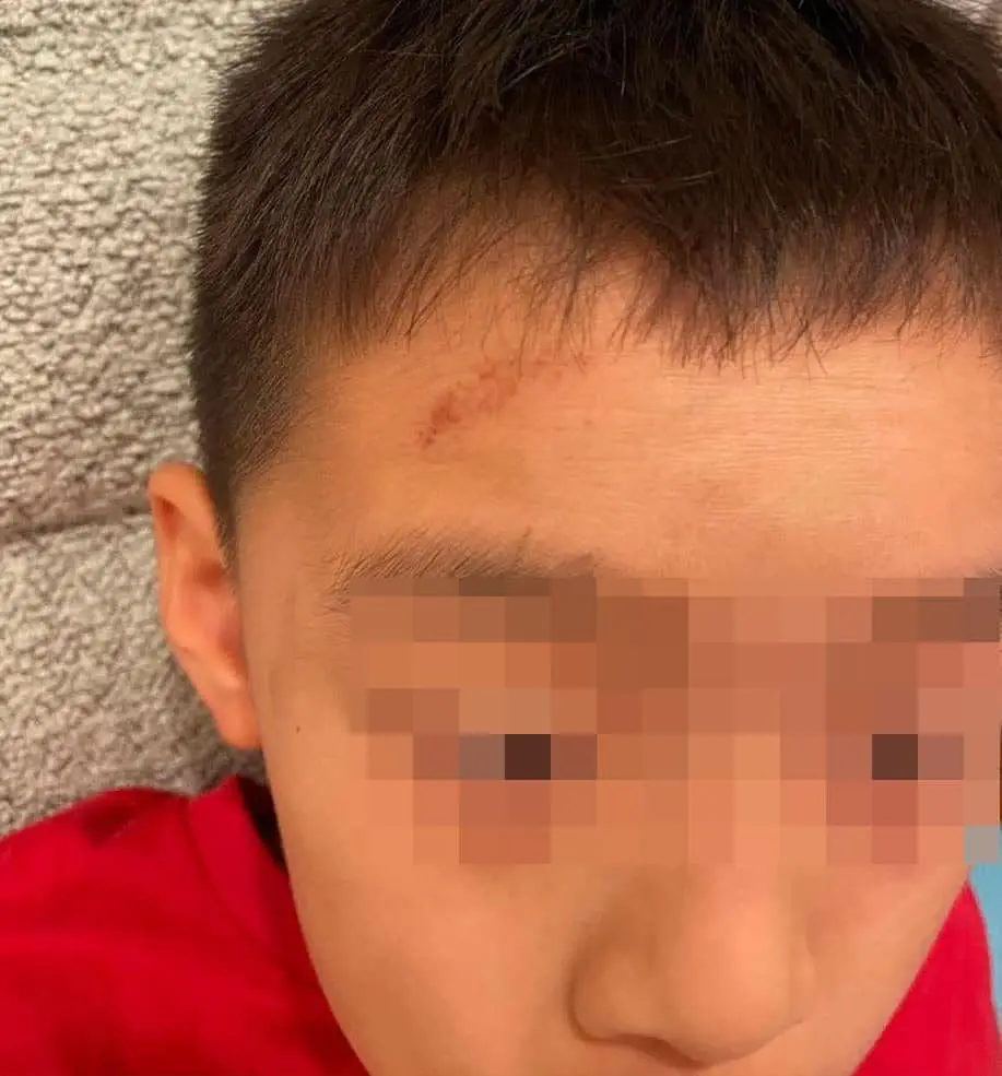 Chinese boy bullied by classmates at Canadian International School