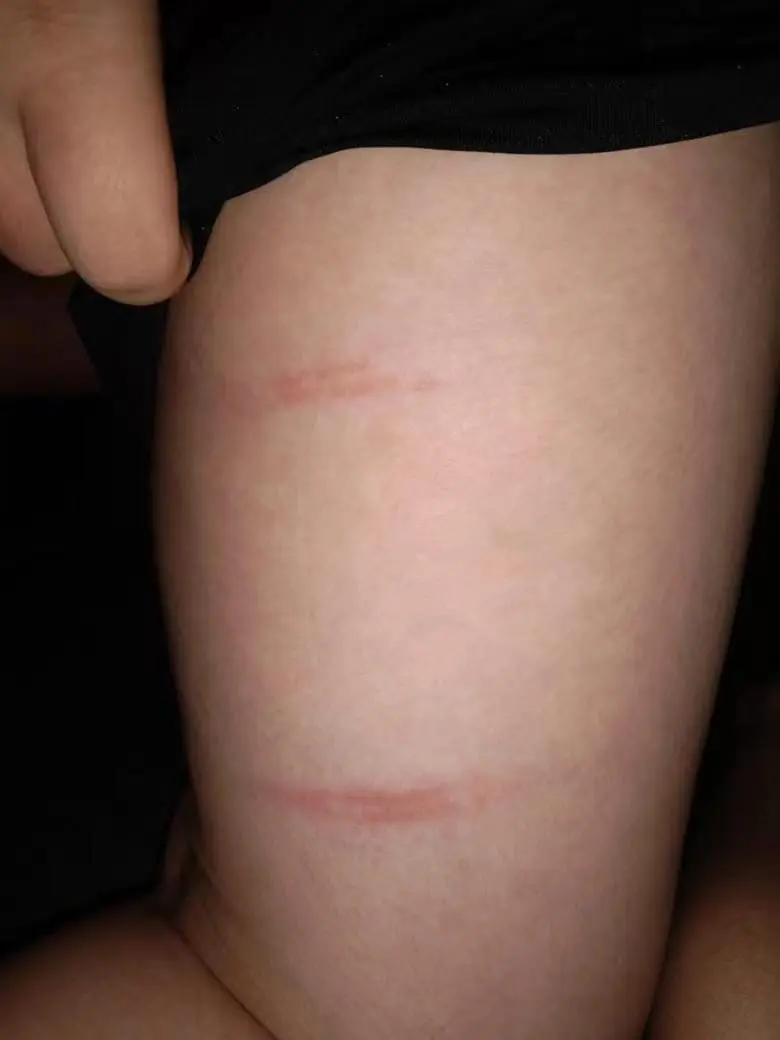 M'sian Student Caned For Solving One Math Question Within 2 Hours, Teacher Apologises