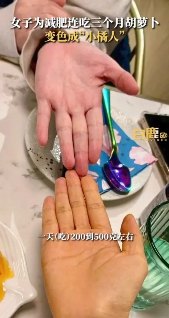 Woman's Skin Turns Orange After She Ate Carrots For 3 Months To Lose Weight