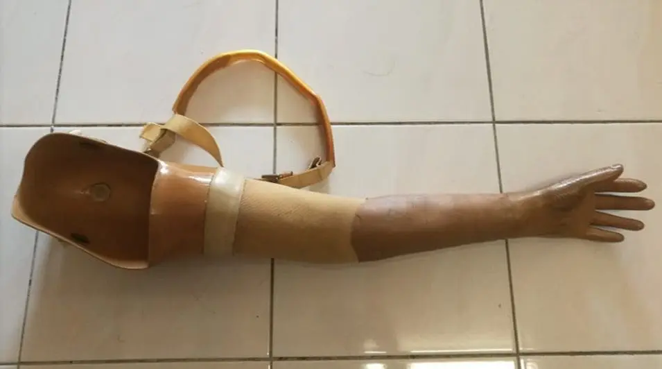 CK Loh's prosthetic limbs 