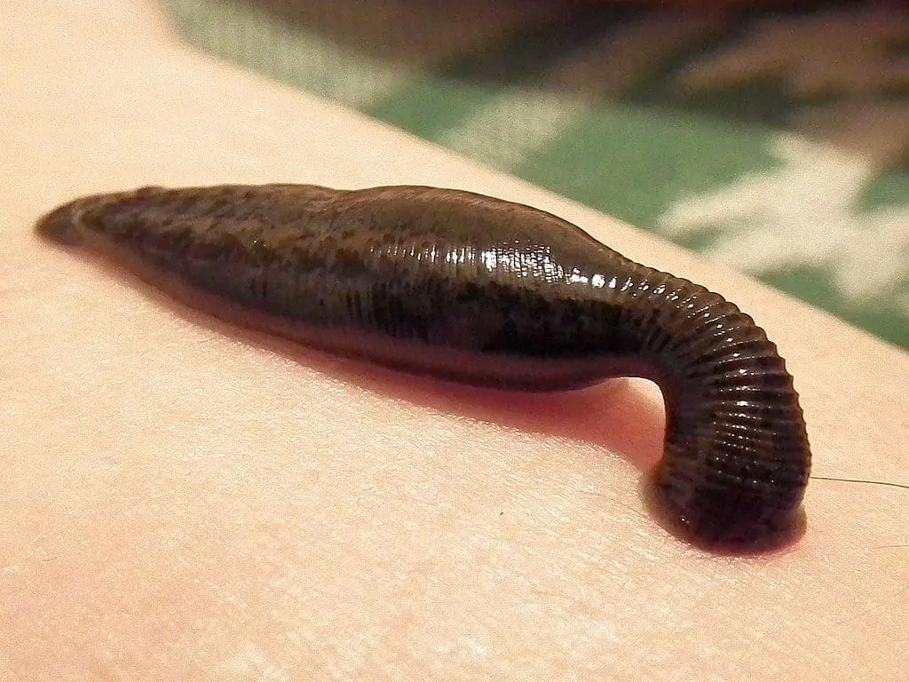 Leech sucking human blood