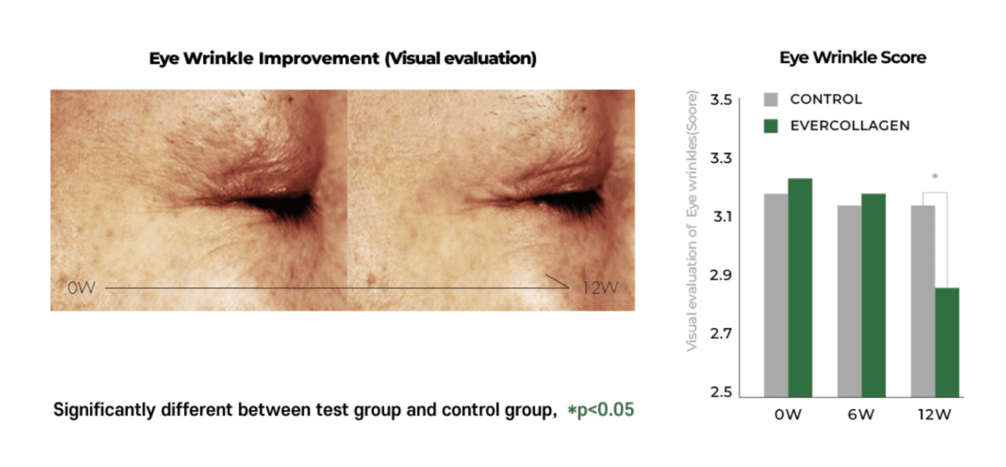 Korea’s No. 1 Collagen Brand, Ever Collagen, Is Now Available At Watsons – Here’s Why You Need It
