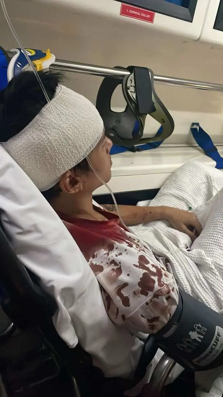 victim of the restroom starhill robbery - july 2024