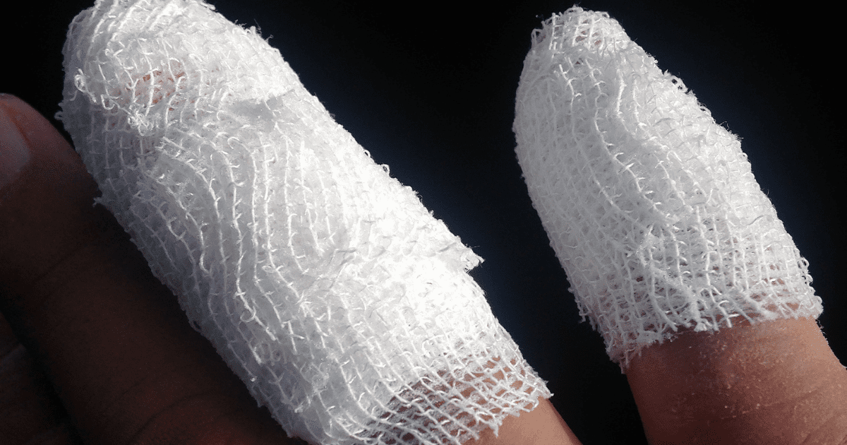 injured fingers