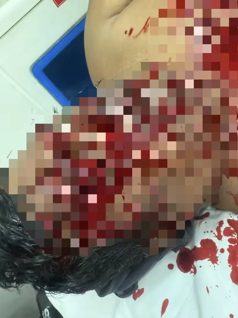 Injuries caused by panther attack