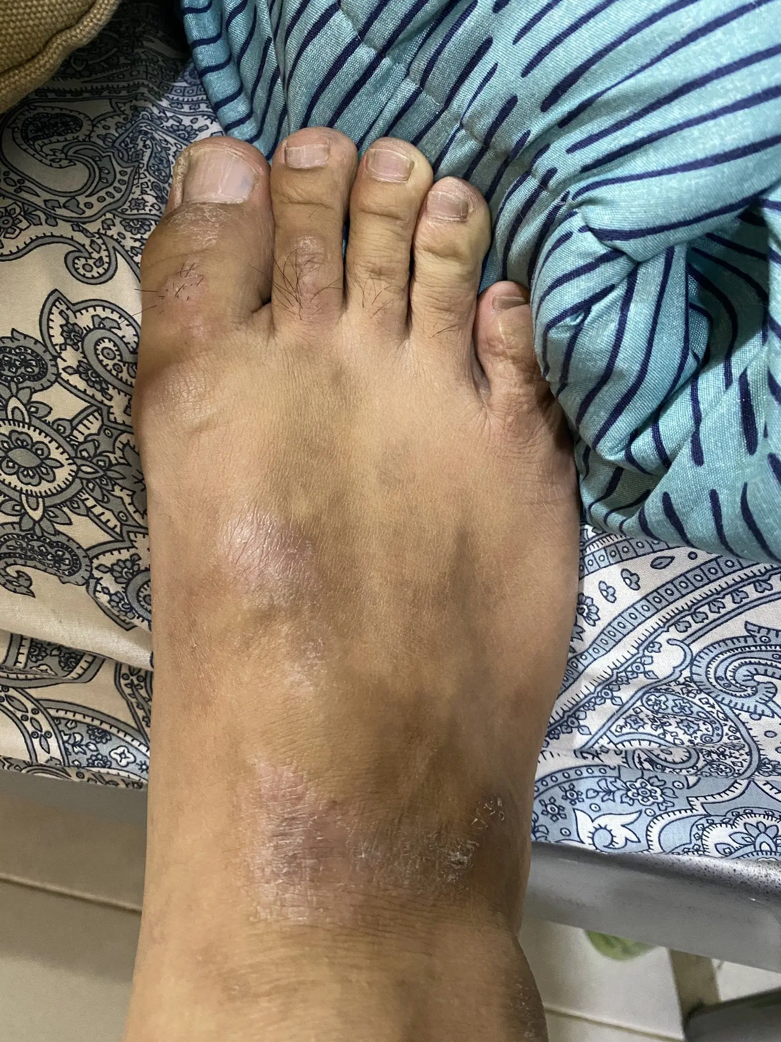 Kelantan Folks Boiled With Rage For The Contaminated Water Supply, Causing Skin Diseases