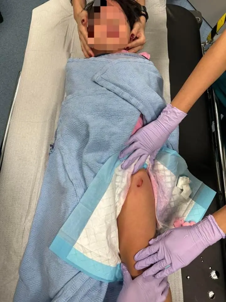 4yo boy getting his wound treated at KK Women's and Children's Hospita