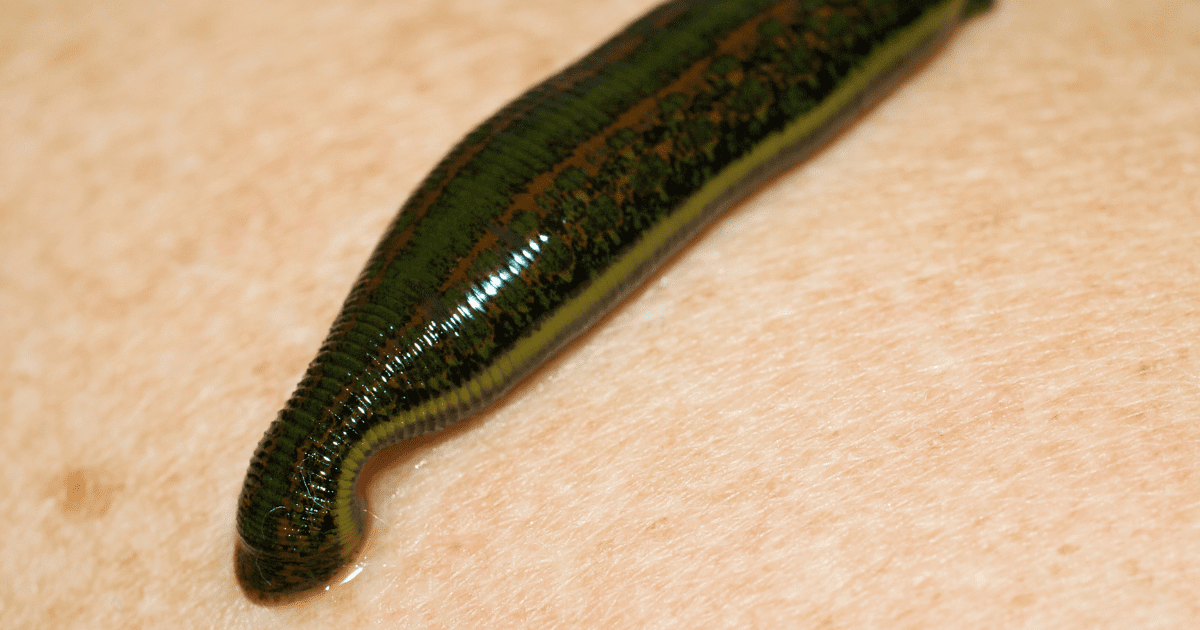 leech on the skin