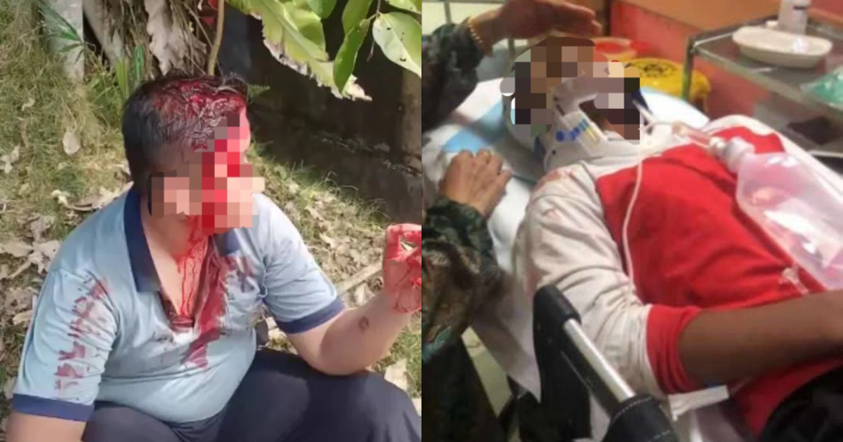 Fight Breaks Out Among Form 3 Students In Johor After One Of Them Threw Eraser At Another