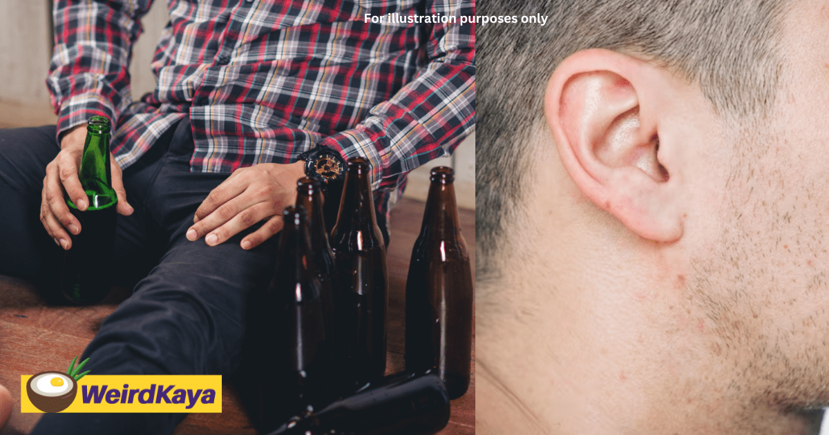 Man Bites Off Colleague's Earlobe While Drunk, Sentenced To 5 Months In Jail