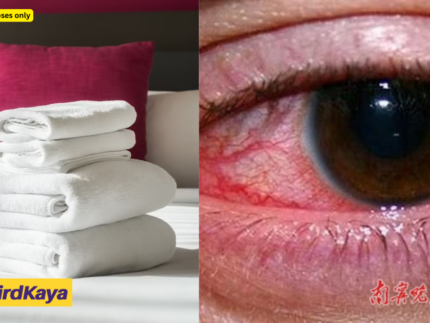 China Man Contracts Gonorrhoea After Using Hotel Towel To Wipe His Face During A Business Trip
