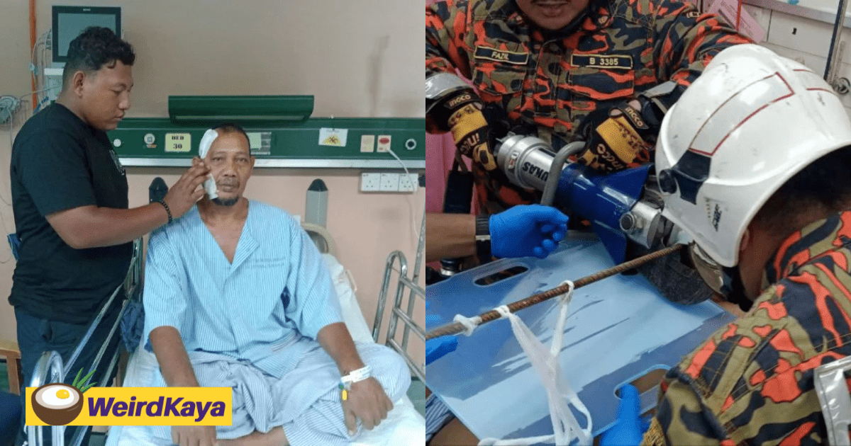 M'sian Man Escapes Death Despite Having Steel Bar Pierce Through His Head