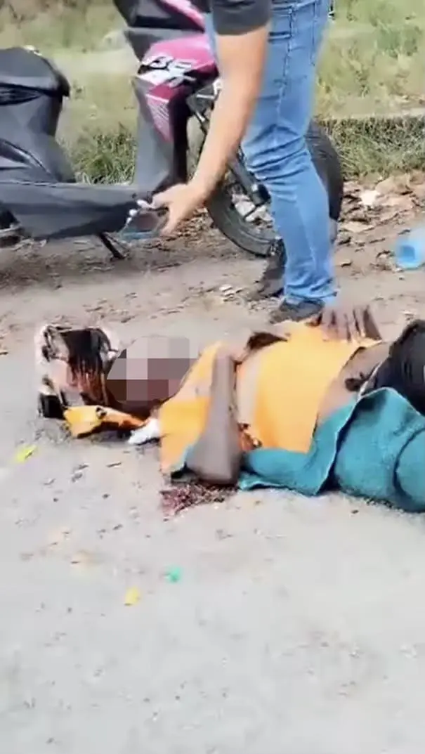 Man wounded after losing eyeball