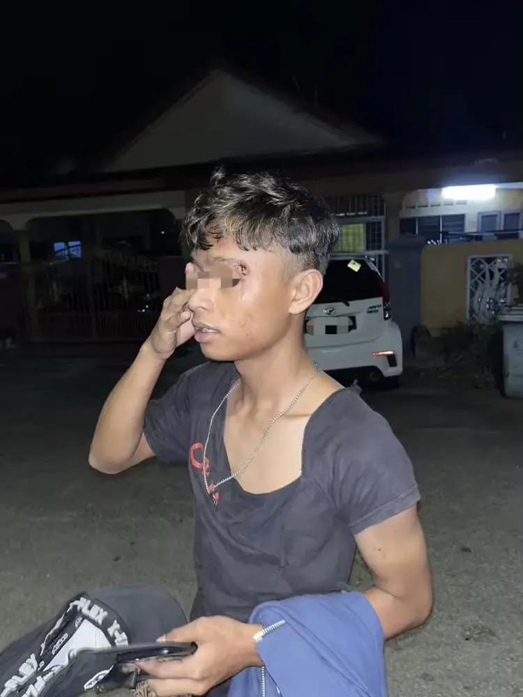 M'sian man beaten over RM9 burger order