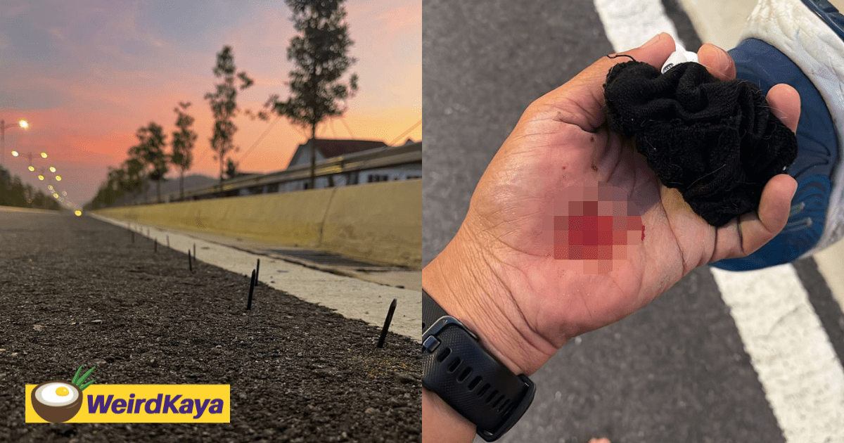 M'sian Man Injured After Stepping On Nails Placed By Roadside While Jogging 