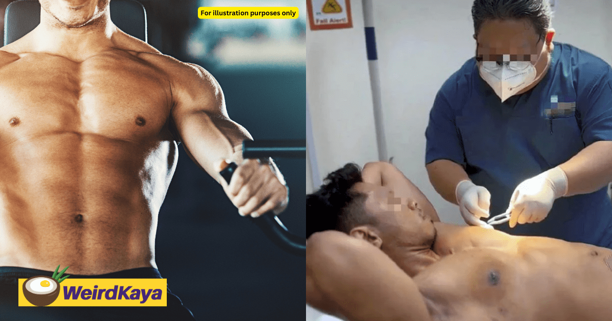 M'sian Man Who Used Steroids For Muscle Gain, Now Undergoes Surgery For Chest Resembling Breasts