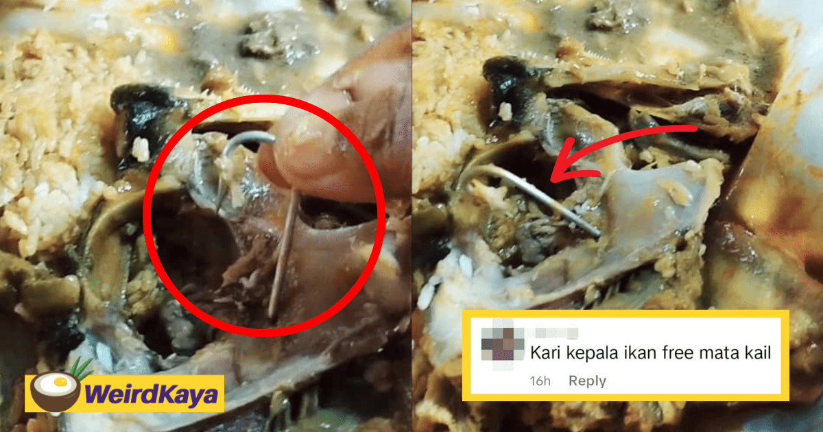 M'sian Woman Shocked To Find Fishhook Inside Her Meal While Eating It Halfway