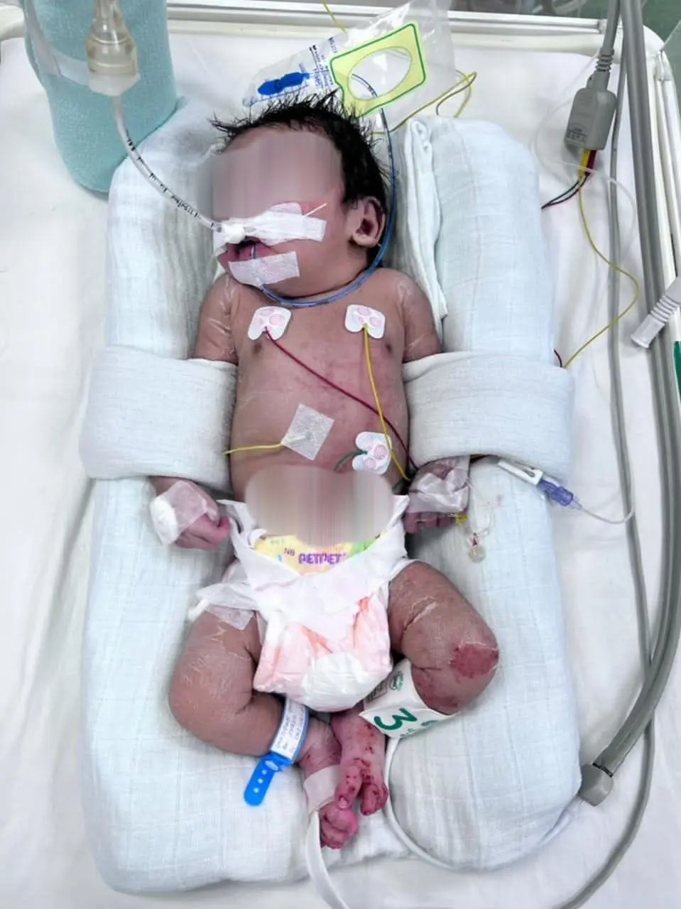 Newborn Baby Abandoned At Ipoh Bus Stop, Entire Body Covered With Ants  2