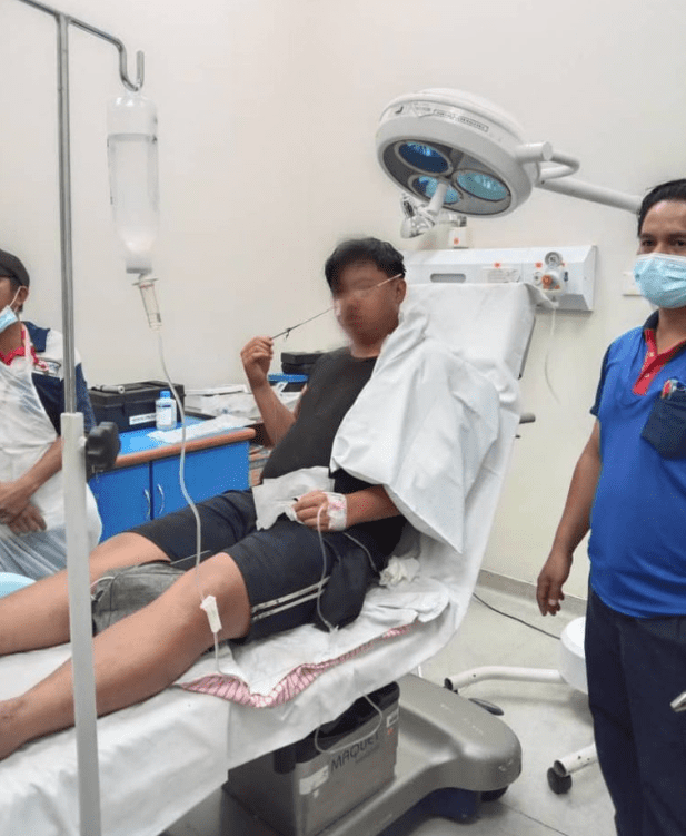 18yo Sabah Teen Gets Arrow Stuck Inside Nose While Fishing With Friends