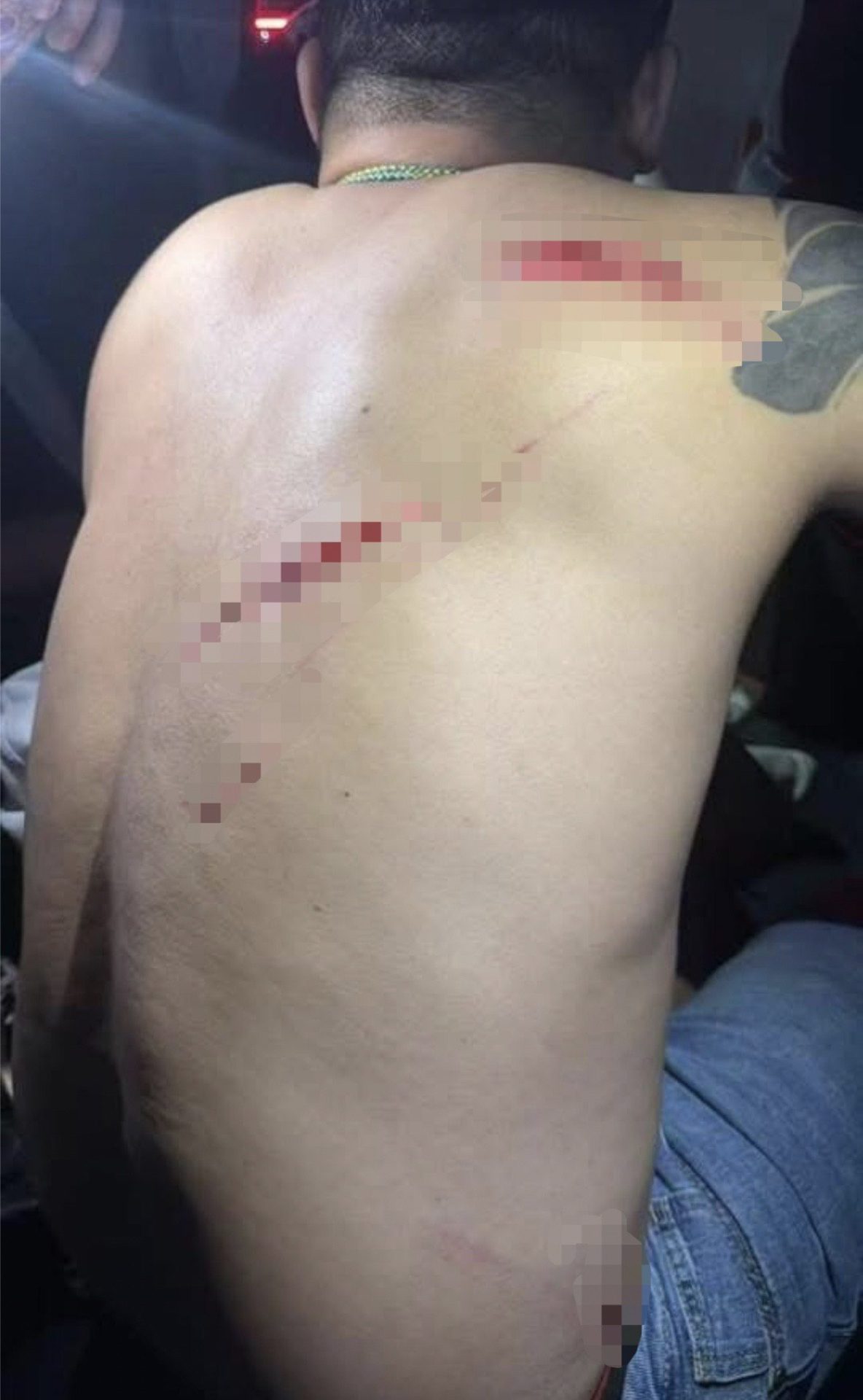 One of them suffering from injuries