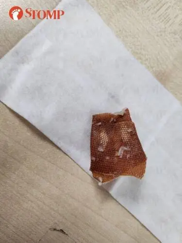 Plaster found inside vegetarian bee hoon