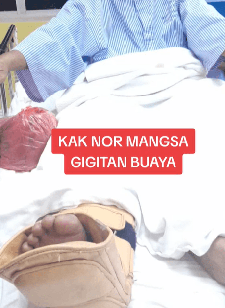 M'sian Woman Dragged Into The River By Crocodile While Sitting By The Side In Melaka 