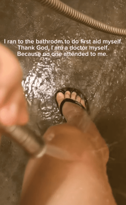 M'sian Woman Suffers Burns After Performer Drops Fire Baton On Her Leg