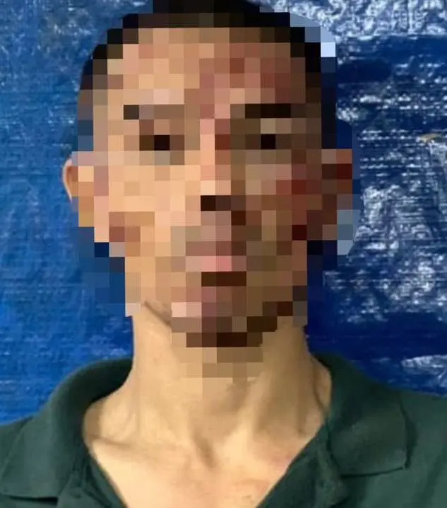 M'sian Police Officer Gets Finger Bitten Off By Man Who Threatened To Splash Acid