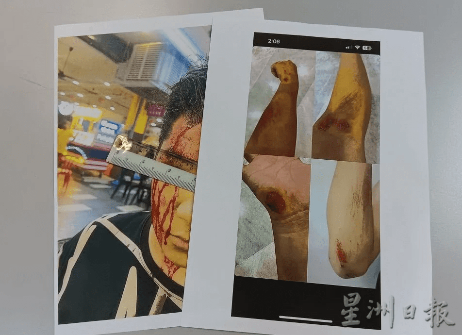 Teens injured by Gang 24 members