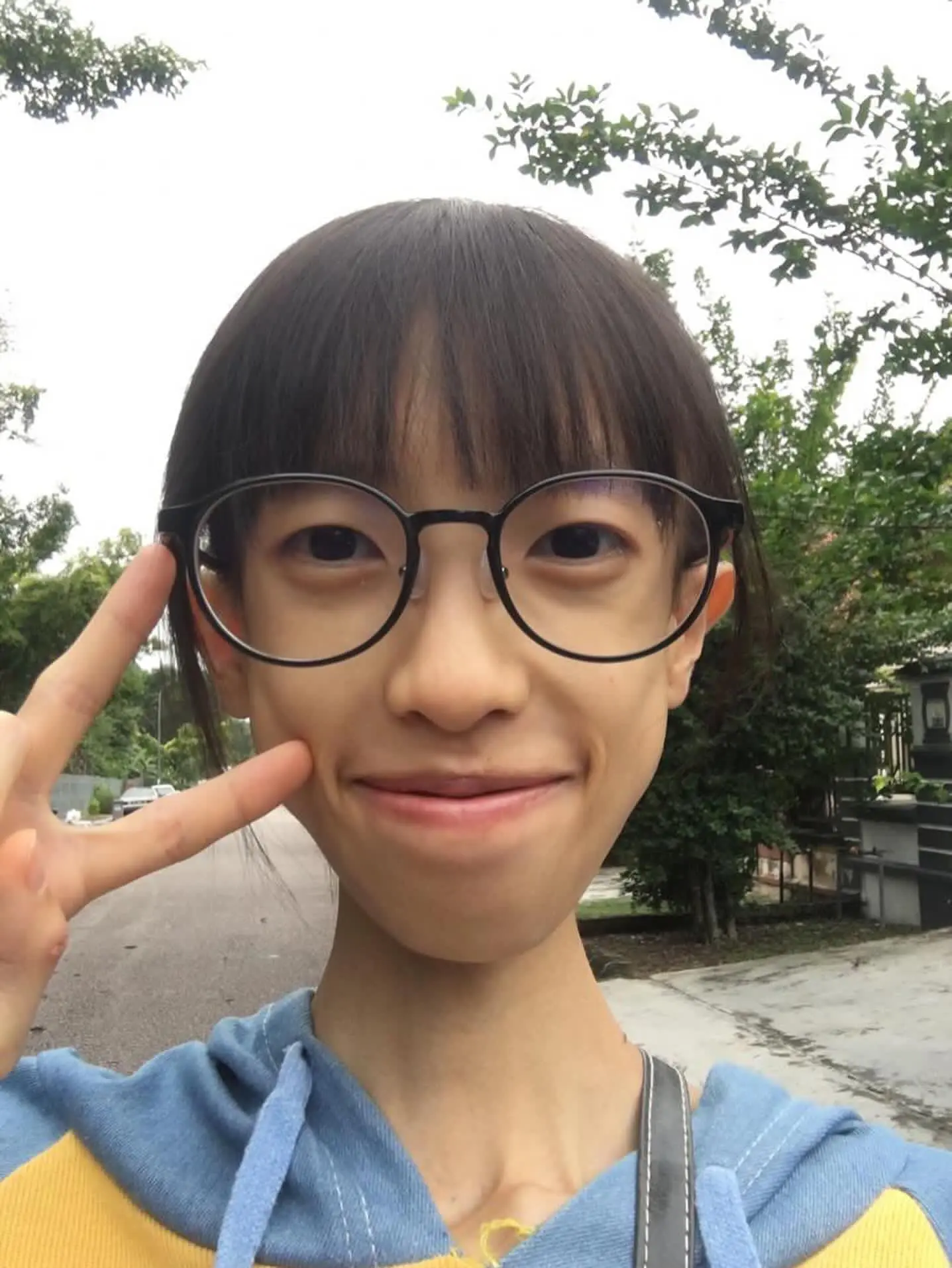 Things getting better fighting anorexia