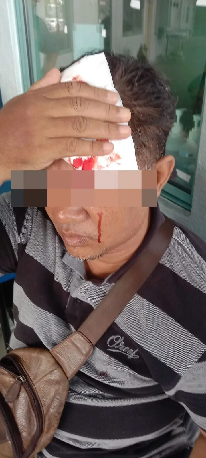 Msian man injured his head after a pole falls on him 